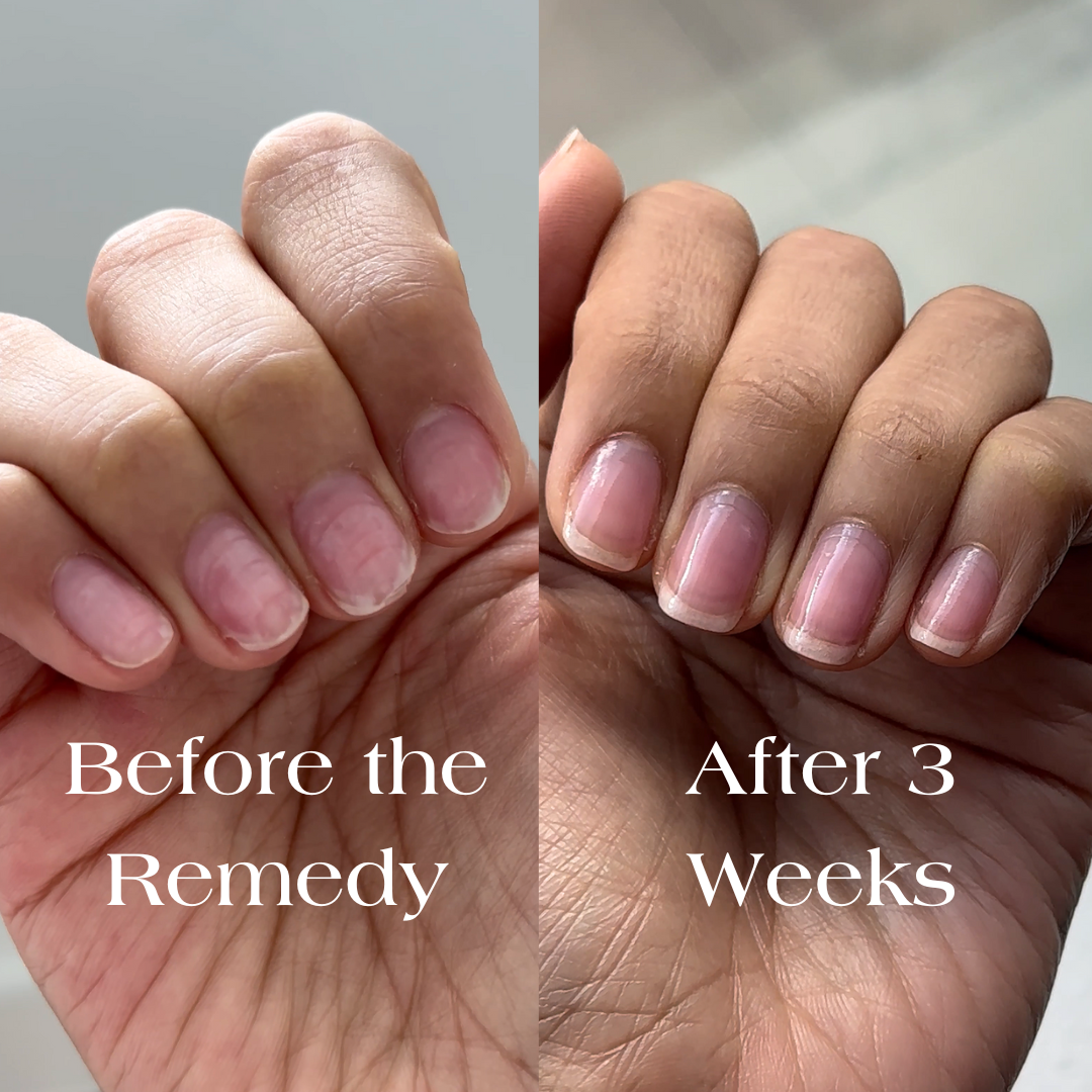 the remedy sheer rose