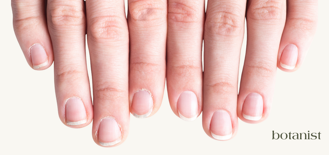How to Get Healthy Cuticles in 5 Easy Steps