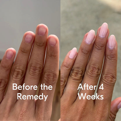 the remedy kiku nude