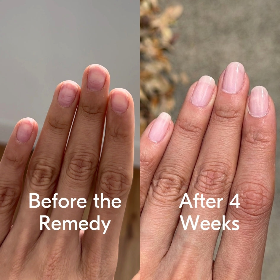 the remedy kiku nude