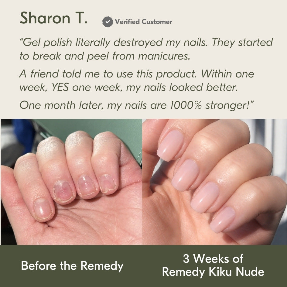 the remedy kiku nude