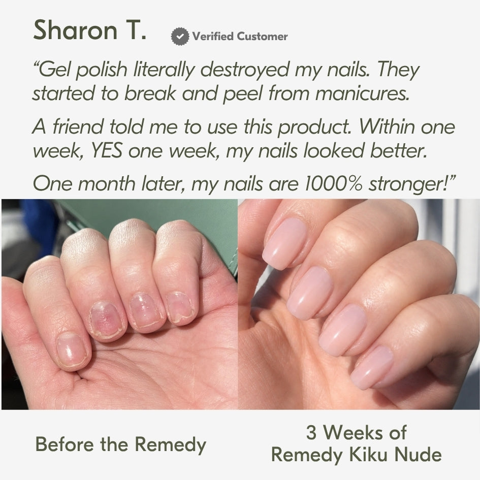 the remedy kiku nude