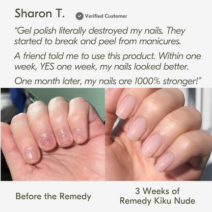 the remedy kiku nude