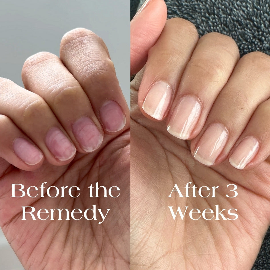 the remedy kiku nude