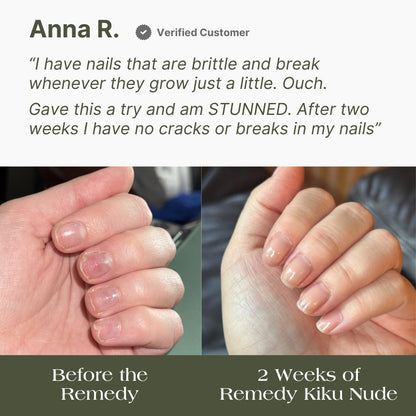 the remedy kiku nude