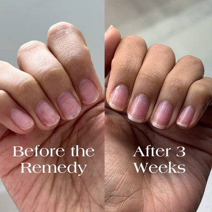 the remedy sheer rose