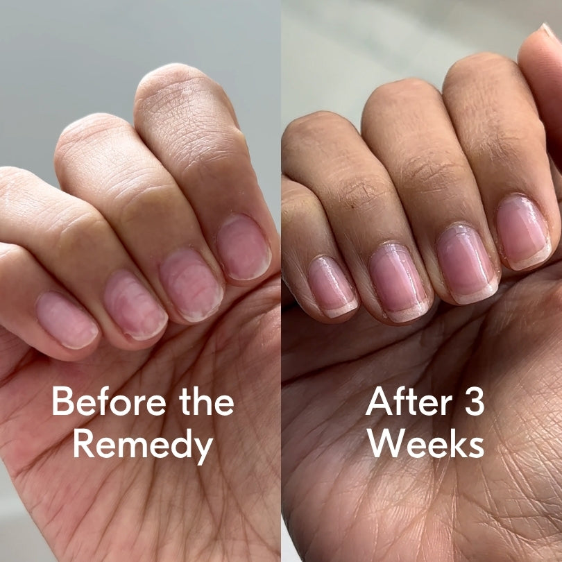 the remedy sheer rose