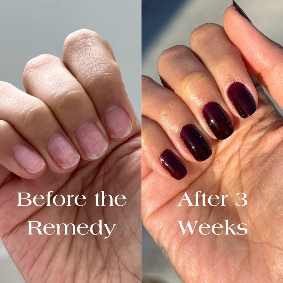 the remedy cherry mocha