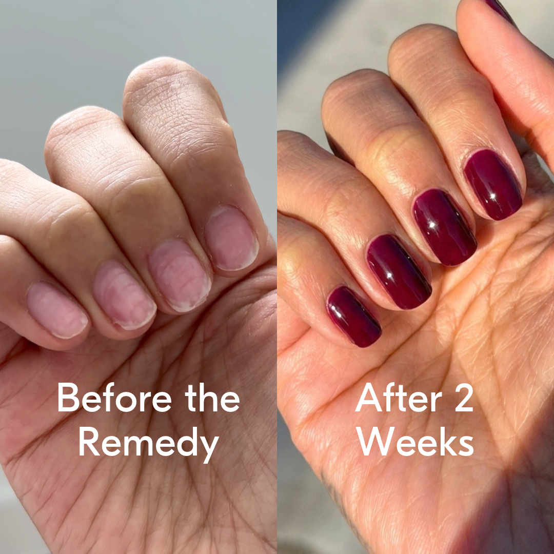 the remedy pomegranate
