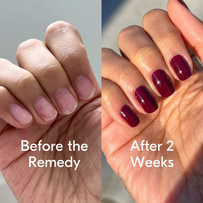 the remedy pomegranate