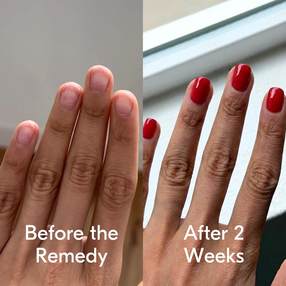 the remedy poppy red