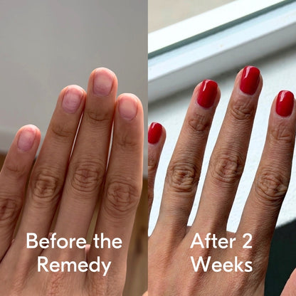 the remedy poppy red