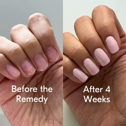 the remedy cherry blossom